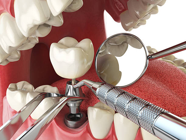 Best Same-Day Emergency Dental Services in Brandermill, VA